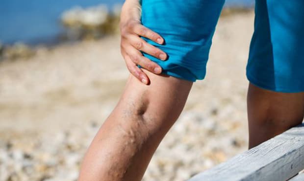 Vein Treatment: A New Standard of Care